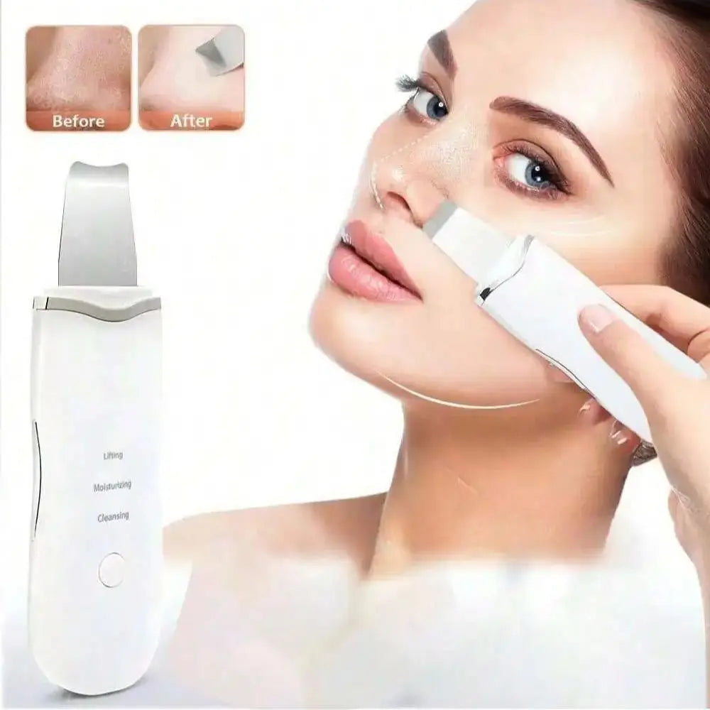 Beauty n Body™ Ultrasonic Skin Scrubber